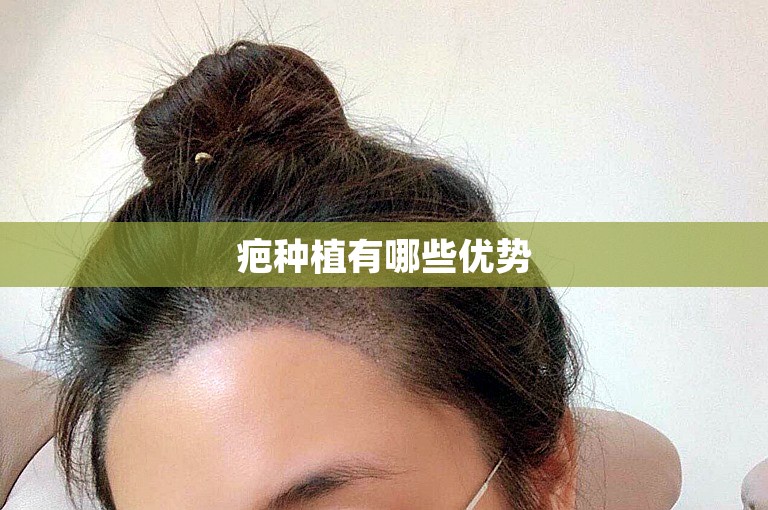 疤种植有哪些优势