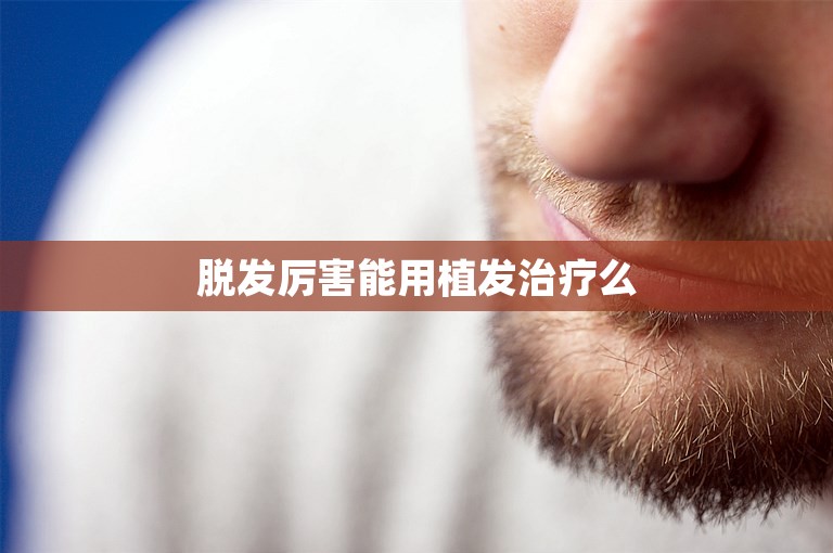 脱发厉害能用植发治疗么