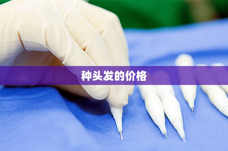 种头发的价格