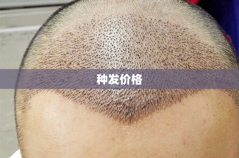 种发价格