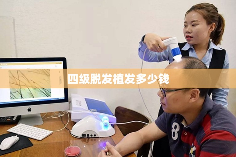 四级脱发植发多少钱