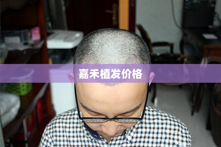 嘉禾植发价格