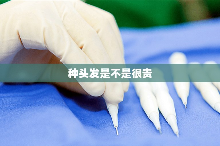 种头发是不是很贵