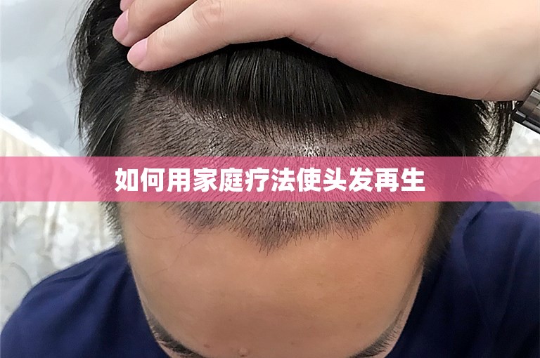 如何用家庭疗法使头发再生