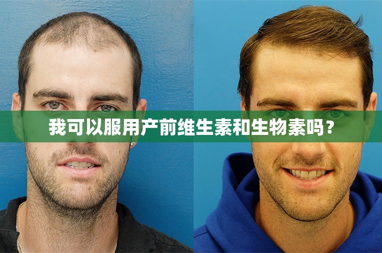 我可以服用产前维生素和生物素吗？