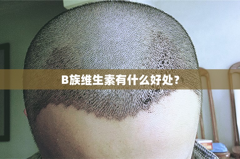 B族维生素有什么好处？