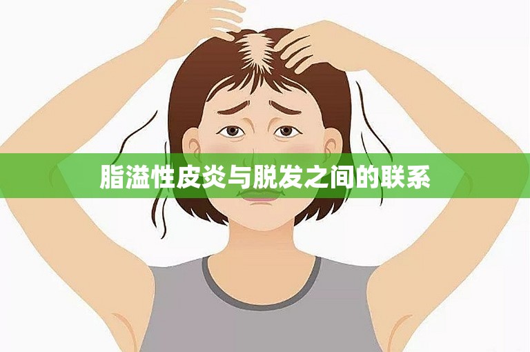 脂溢性皮炎与脱发之间的联系