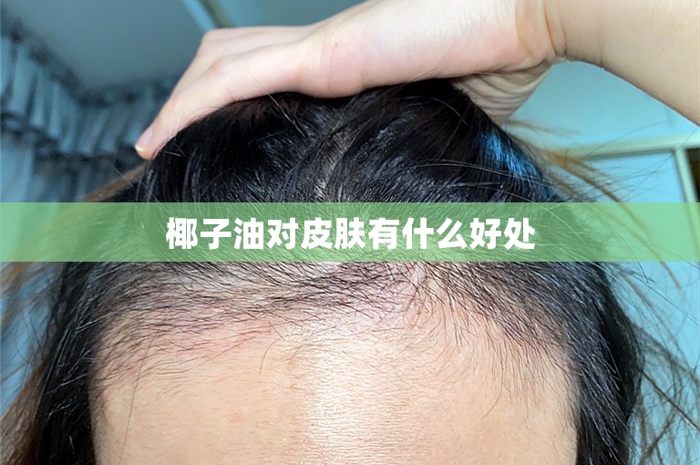 椰子油对皮肤有什么好处