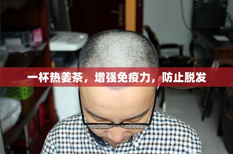 一杯热姜茶，增强免疫力，防止脱发