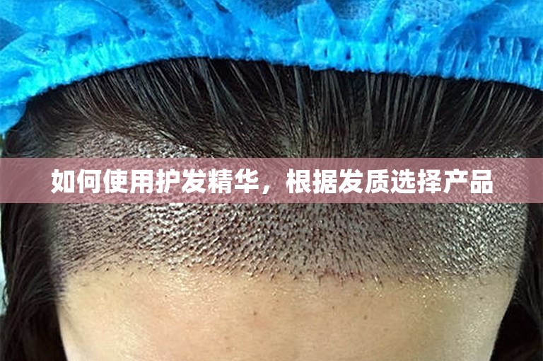 如何使用护发精华，根据发质选择产品