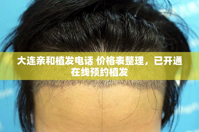 大连亲和植发电话 价格表整理，已开通在线预约植发