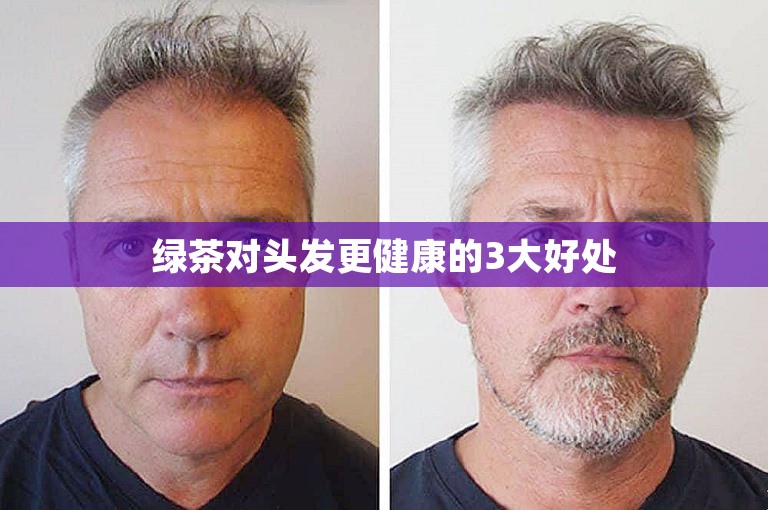 绿茶对头发更健康的3大好处