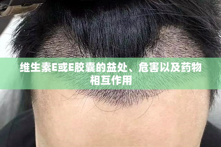 维生素E或E胶囊的益处、危害以及药物相互作用