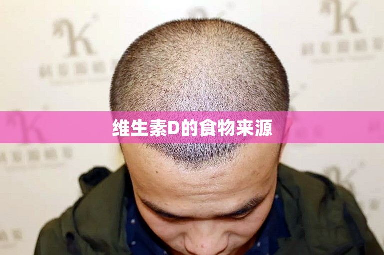 维生素D的食物来源