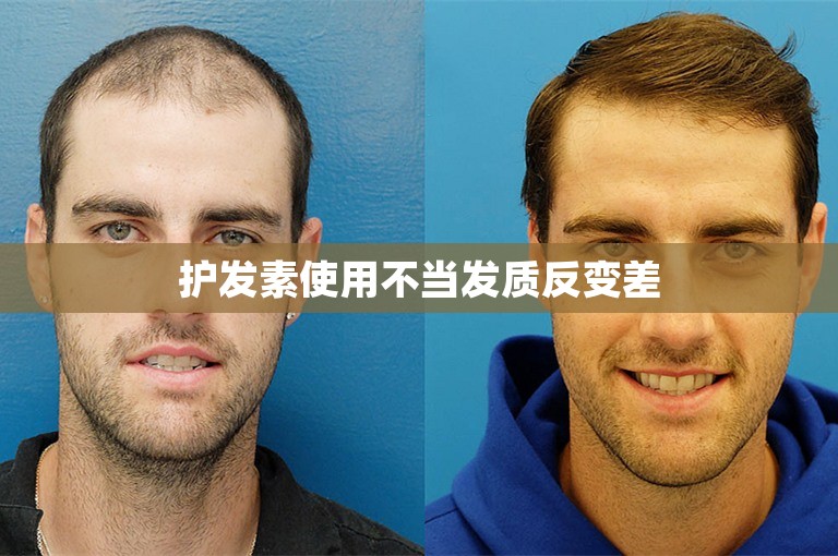 护发素使用不当发质反变差