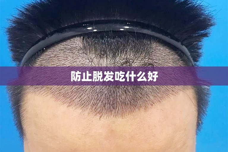 防止脱发吃什么好