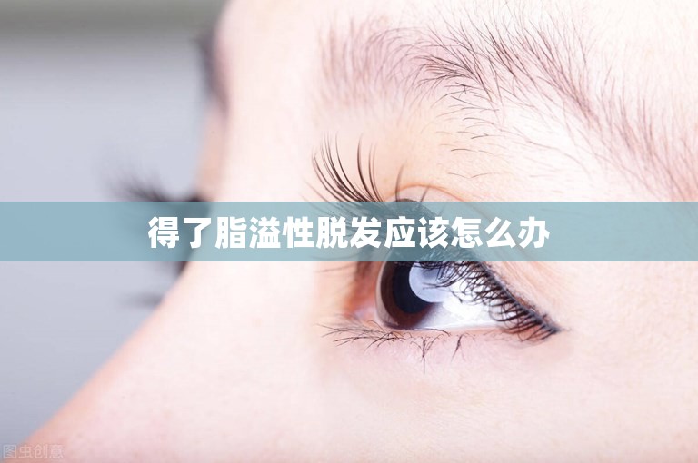 得了脂溢性脱发应该怎么办