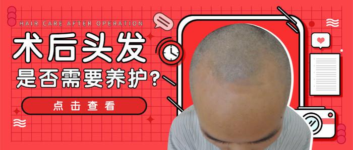 植发后到底需要术后养护吗？为什么说法不一？
